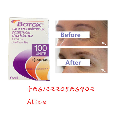 Alternder Antifalten-Botulinumantigiftstoff Allergan schreiben ein Botox-Pulver