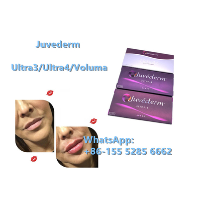 Hautfüller-Antifalten-Hyaluronsäure-Einspritzung Juvederm Ultra4 24mg/Ml