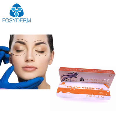 Langlebiger Fosyderm-Hyaluronsäure-Hautfüller für die kosmetische Injektion