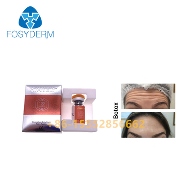 Antifalten-Einspritzungs-Botulinumgiftstoff Hyamely 100units Botox