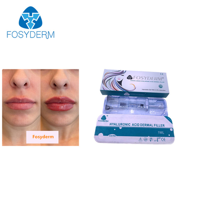 Einspritzung Fosyderm der Hyaluronsäure-1ml Hautfüller für Lippe
