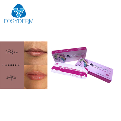 Hautfüller Hyaluronsäure-Einspritzung Fosyderm für Kreuz der Lippen2ml verband