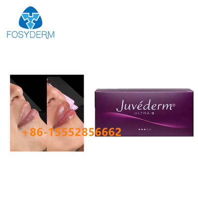 Verbesserung Juvederm der Lippen2x1ml füller-Kreuz verbundene Hyaluronsäure-Einspritzung Haut