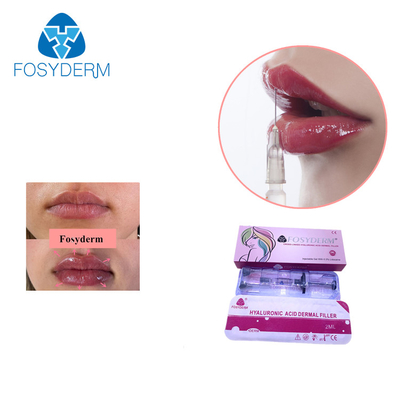 Fosyderm-Kreuz verband Hyaluronsäure-Hautfüller für Haut-Verjüngung