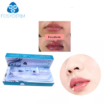 Transparente Gel-Hyaluronsäure-Hautfüller für Gesichts-Lippe 24mg/Ml