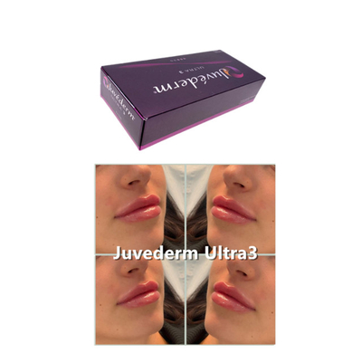 2 ml Hyaluronsäure Hautfüllmittel Juvederm Voluma For Anti Aging Ultra3 Ultra4