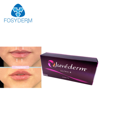 Juvederm 2*1ml Hyaluronsäure Hautfüllmittel Lippenvergrößerung Kinnvergrößerung