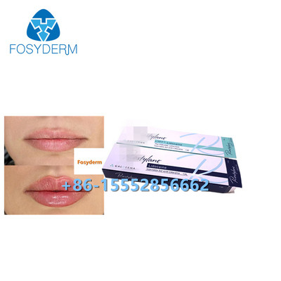 1 ml Hyaluronsäure Hautfüllmittel gegen Falten Lippenvergrößerung