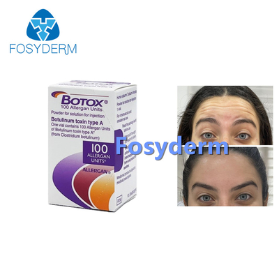 100 Einheiten Botulinumtoxin Allergan Anti Falten Injektion Botox Typ A
