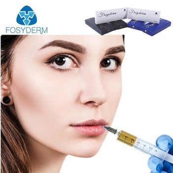 Hyaluronsäure-Lippeneinspritzungs-Füller 1ml für die Lippen, die CER-ISO-Bescheinigung füllen