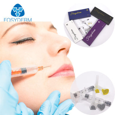 Hyaluronsäure-Hautfüller der Schönheitspflege-1ml mit Lidocaine für Lippenvergrößerer