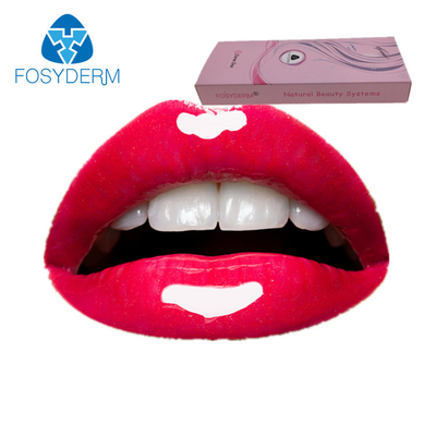 Hyaluronsäure-Füller Lidocaine 2ml Derm, Lippeneinspritzungs-Fülle ha-Gel mit Lidocaine