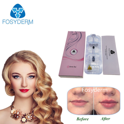 Hyaluronic Stift-Gebrauchs-Hyaluronsäure-injizierbarer Hautfüller für die Lippe Nasolabial und Gesicht