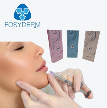 Transparente Hyaluronsäure-Füller-Einspritzungs-Gesichtsimplantat 12 Monate Dauer-