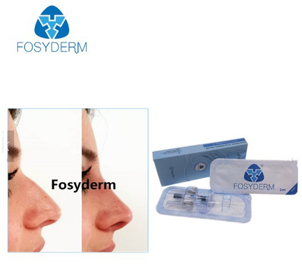 Tiefe Linie Salzsäure-Einspritzungen Fosyderm 1ml im Gesicht für Nase oben