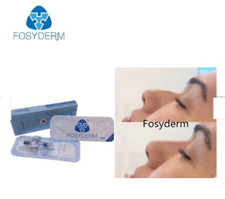 Fosyderm-Kreuz verband tiefe Linie Hautfüller des Füllers 2ml für Nase oben