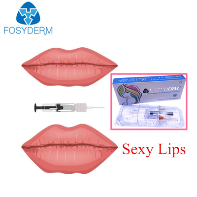 Fosyderm-Hyaluronsäure-Hautfüller für Lippenfülle tiefe Linie von 2 ml