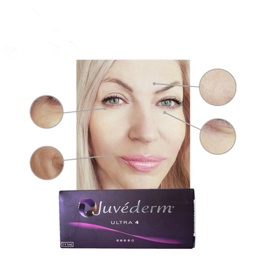 Juvederm Ultral 4 Hyaluronsäure-Hautfüller-Einspritzungen mit Lidocaine