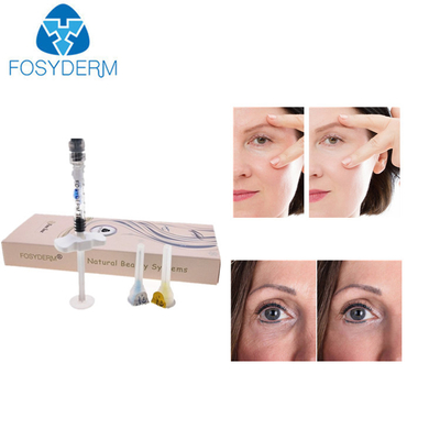 Augen-Falten-Hyaluronsäure-knittert Hautfüller-Gesichtsbehandlung Einspritzungs-Füller