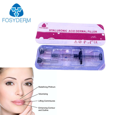 Fülle der Lippen2ml durch das Einspritzen des Fosyderm-Hyaluronsäure-Hautfüllers