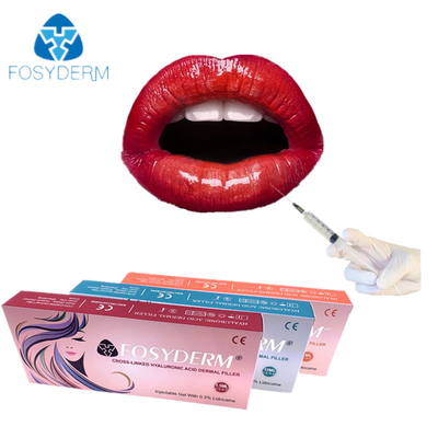 Hyaluronsäure-Hautfüller mit Lippenvermehrung des Lidocaine-1ml