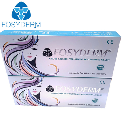 Füllende Hyaluronsäure-Lippenfüller 1ml Gesichts-Einspritzung Fosyderm Fosyderm