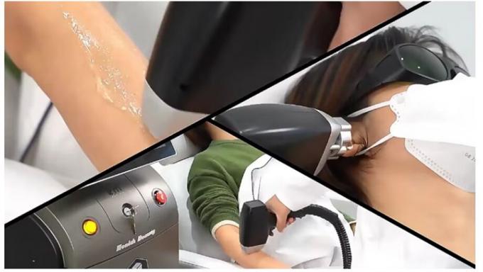 Leistungsstarke neue 808nm Ice Diode Trio 3 Welle Diode Laser 810nm Depilation 808 Nm Haarentfernung 3 Wellen Titan Medical Machi 2