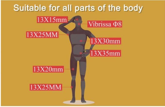 Leistungsstarke neue 808nm Ice Diode Trio 3 Welle Diode Laser 810nm Depilation 808 Nm Haarentfernung 3 Wellen Titan Medical Machi 3