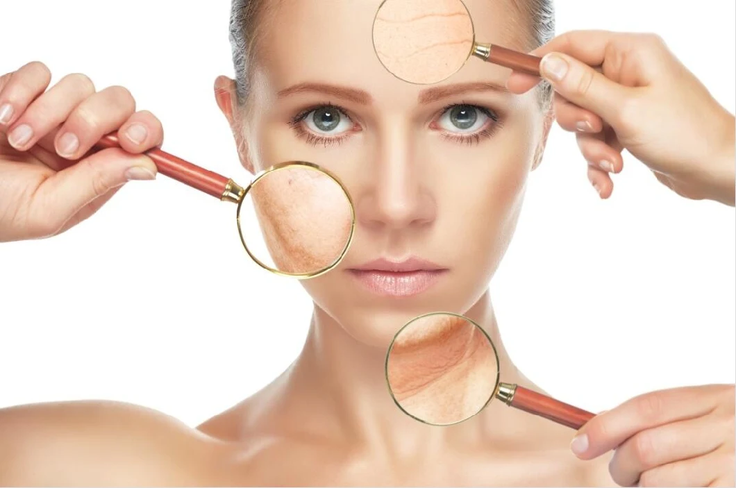 Hyamely Hyaluronsäure Meso-Lösung Hautfüllmittel Mesotherapie-Serum zur Hautpflege 0
