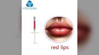 rote Lippen