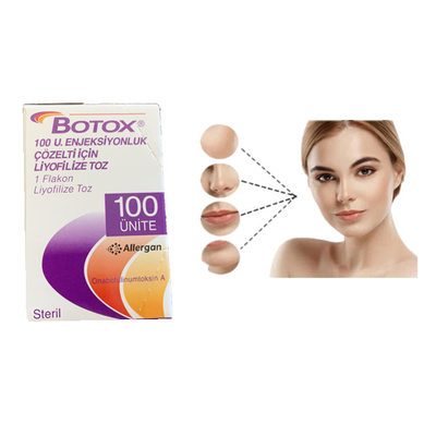 GIFTSTOFF Allergan 100units Botulinum-Einspritzungs-Falten-Abbau-Operation