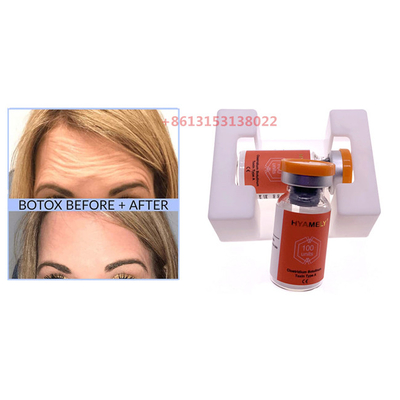 Hyamely- Botulinumgiftstoff Botulax-Pulver-Einspritzungs-Antifalten