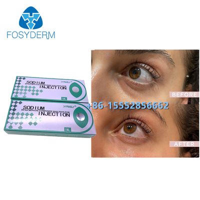 zusammengesetzte Lösung Natrium-1ml Hyaluronate entfernen Augenringe