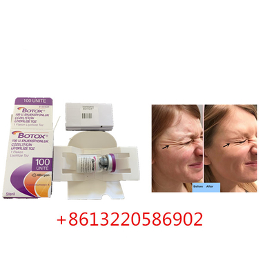 Alternde Antieinspritzung 100units Allergan  schreiben eine Antifalte