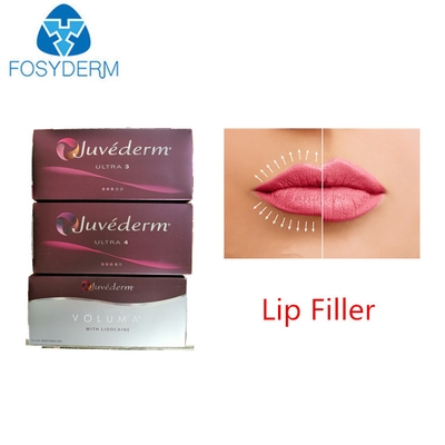 Juvederm ultra 3 Hyaluronsäure-Hautfüller für Gesichts-Lippen