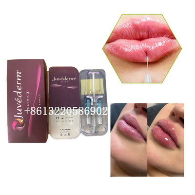 Ultra3 Juvederm Lippenhyaluronsäure der Füller-Einspritzungs-2ml Haut