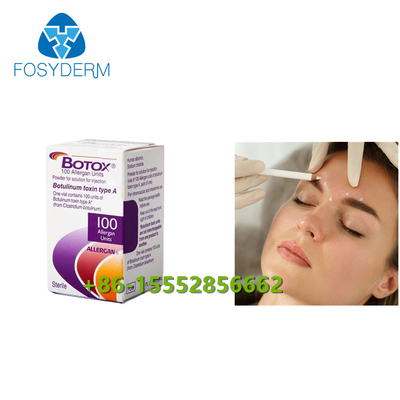 100 Allergan-Einheits-Botulinumgiftstoff alternde -Antieinspritzung