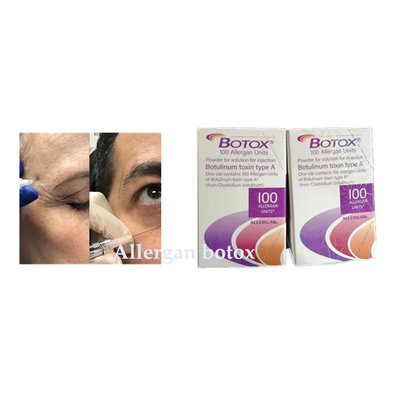 Botulinumeinspritzung giftstoff Allergan  für Falte entfernen