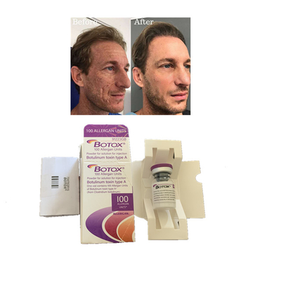 Allergan  100 Einheiten Typen Botulinumtoxin-Injektion Anti-Falten