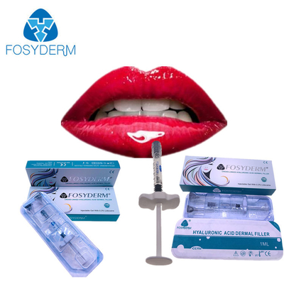 Lippenprallere ha-Füller-Einspritzung Fosyderm 1ml Derm