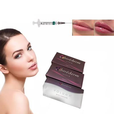 Hyaluronsäure-Hautfüller-Lippenverbesserung Juvederm Ultra3