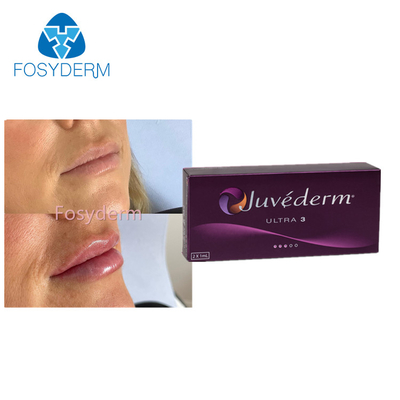 Lippenverbesserungs-Hyaluronsäure-Hautfüller 2x1.0ml Juvederm Ultra3