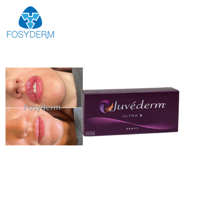 Verbesserung Juvederm der Lippen2x1ml füller-Kreuz verbundene Hyaluronsäure-Einspritzung Haut