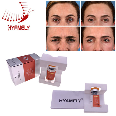 Botulinumgiftstoff-Einspritzung Korea-Materialien Hyamely  für Gesichtsfalten