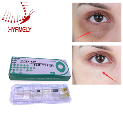 Werden Sie die Augenringe los, die Hyamely-Füller-Lösung zum Entfernen einspritzen