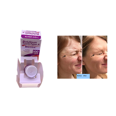 Allergan 100 Einheiten für Falten-Abbau-Hautfüller-Einspritzung