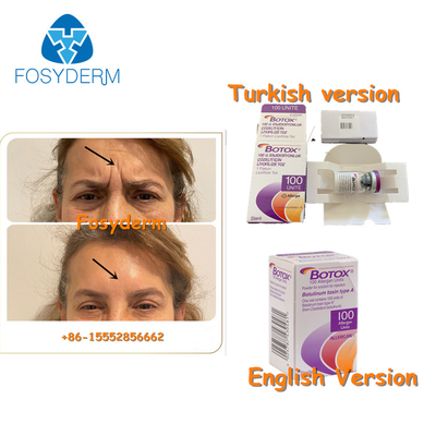 100Units Allergan Botulinum-Toxion für entfernen Gesichtsfalten Botox-Art A