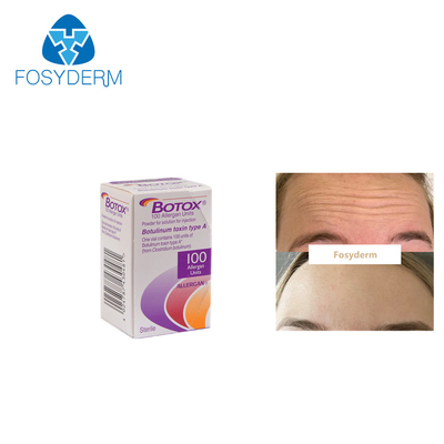 100Units Allergan Botulinum-Toxion für entfernen Gesichtsfalten -Art A