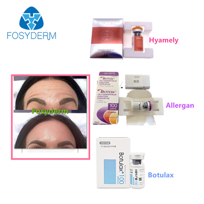 100 Einheiten schreiben einen Botulinumgiftstoff Allergan, das Antigesichtsbehandlung Einspritzung  Botulax knittert