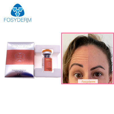 100 Einheiten schreiben einen Botulinumgiftstoff Allergan, das Antigesichtsbehandlung Einspritzung  Botulax knittert